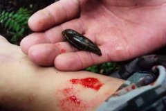 螞蟥咬人怎么辦？螞蟥怎么能殺死？